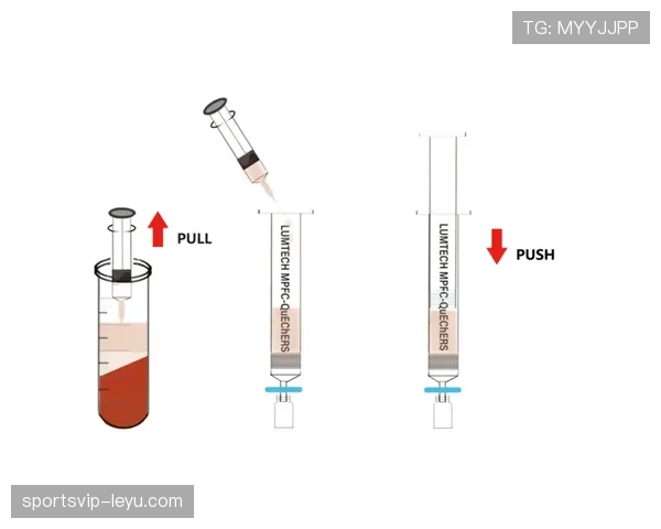 格里兹曼回撤组织中的串联作用解析